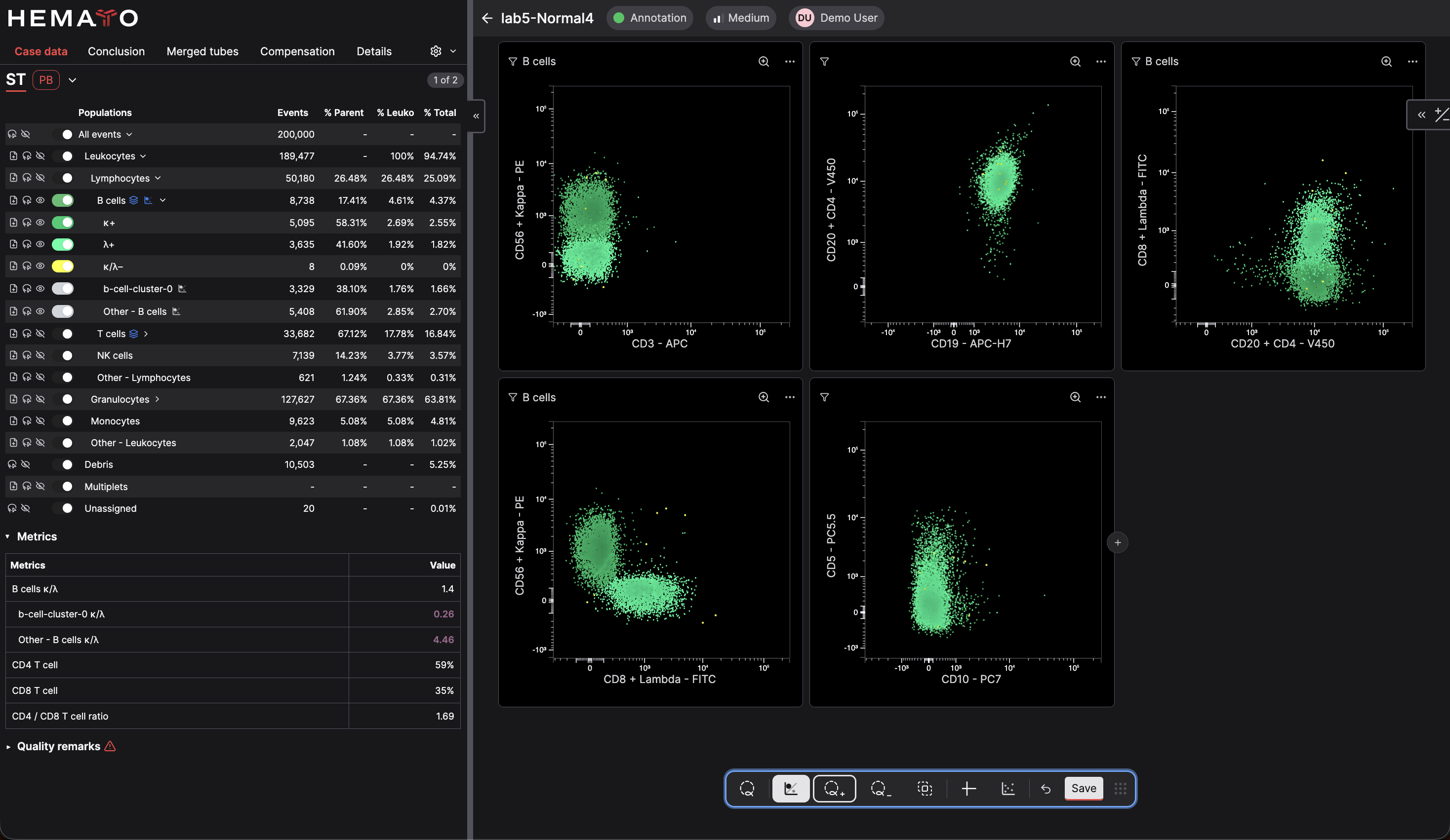 CellStudio analysis showing kappa and lambda clonality scatter plots for several B-cell populations