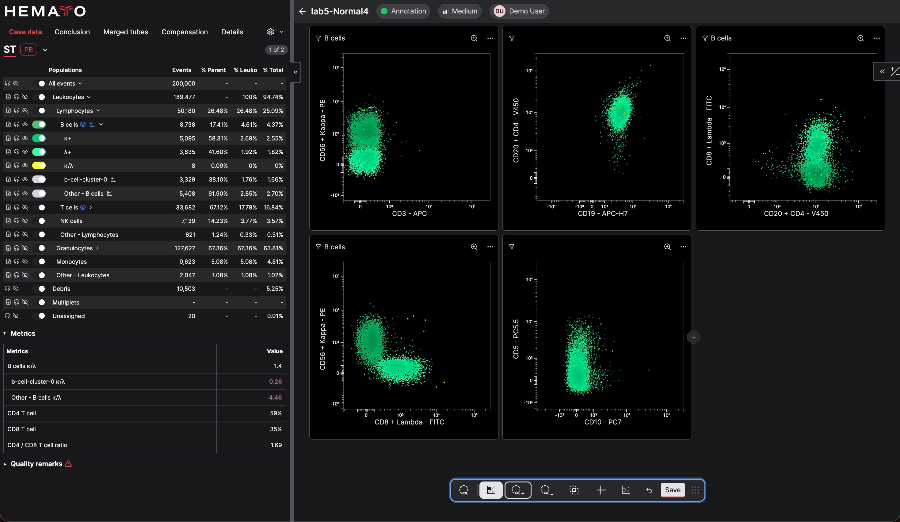CellStudio analysis showing kappa and lambda clonality scatter plots for several B-cell populations
